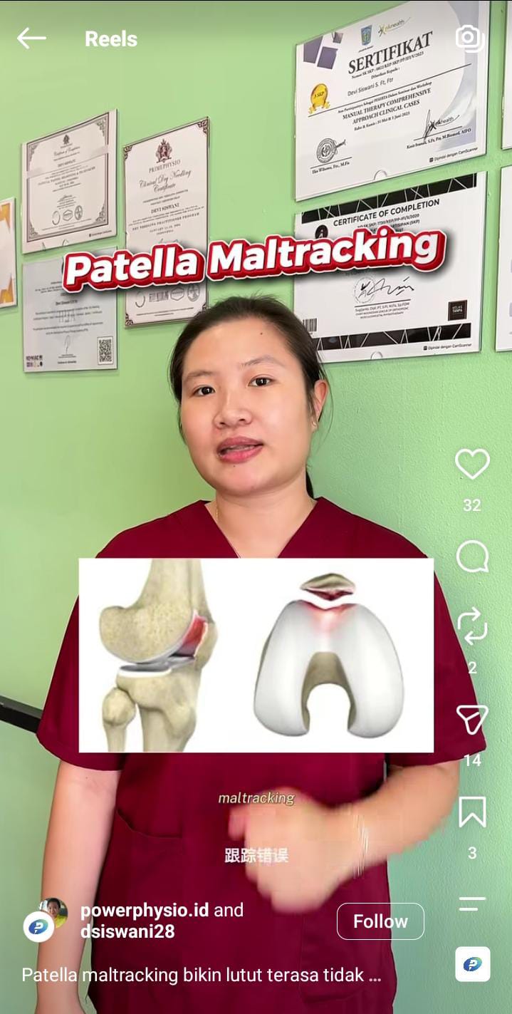 Patella Maltracking